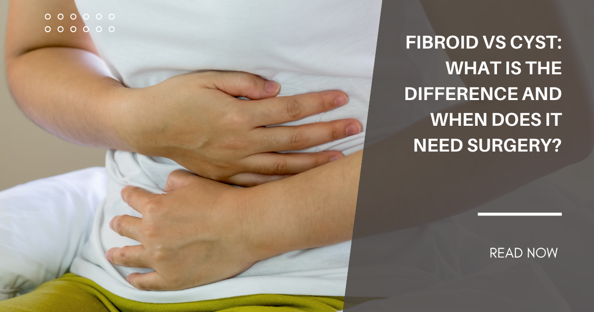 fibroid-vs-cyst